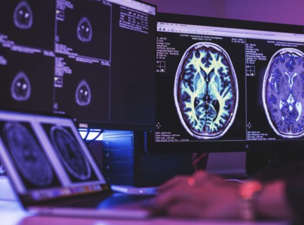 Clinician reviewing quantitative brain MRI maps across multiple monitors