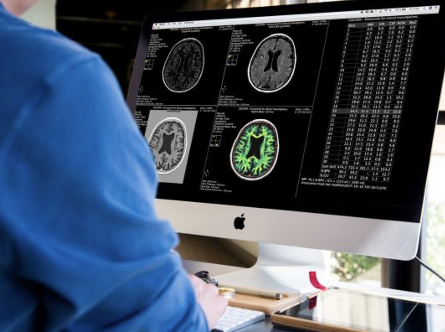Clinician reviewing multiple STAGE output views on a monitor