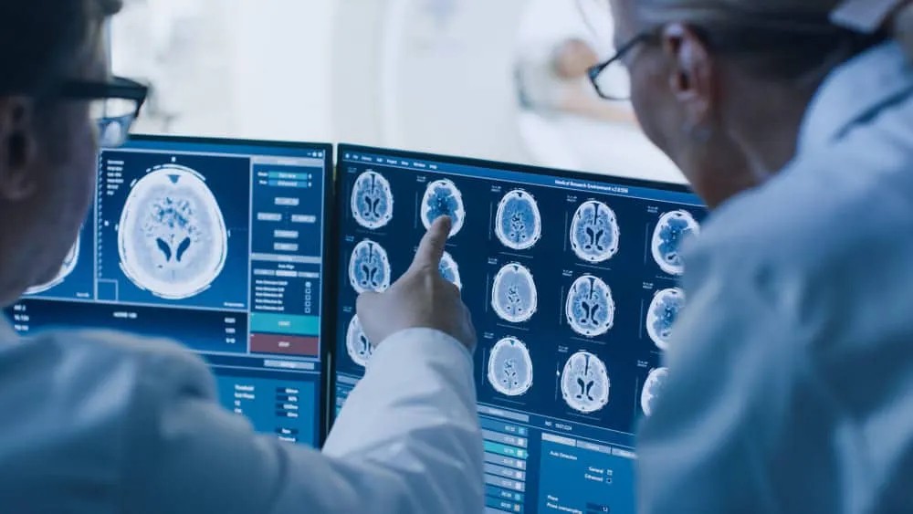 Clinicians reviewing brain MRI/CT scans together on a diagnostic workstation