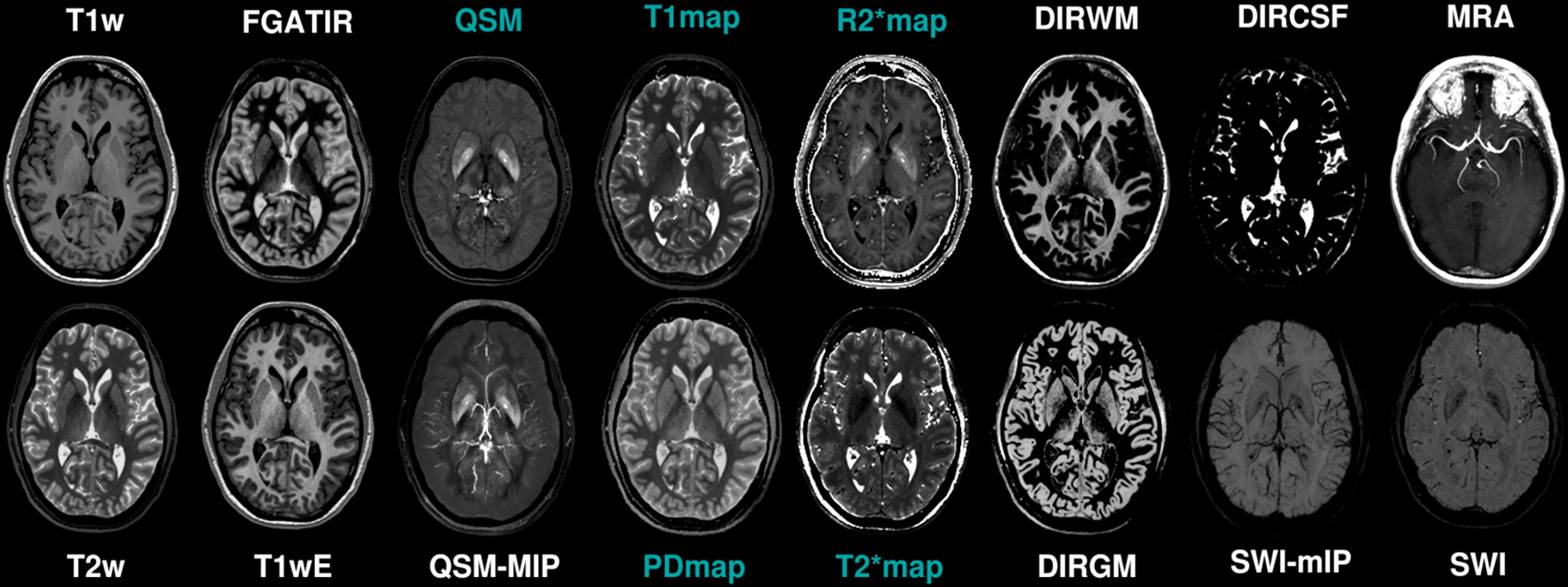 Representative STAGE output suite from one acquisition: T1w, FGATIR, QSM, T1 map, R2* map, DIRWM, DIRCSF, MRA, T2w, T1wE, QSM-MIP, PD map, T2* map, DIRGM, SWI-MIP, SWI